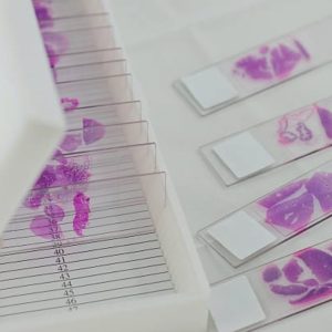 Hematoxylin & eosin stain