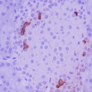 Immunohistochemistry